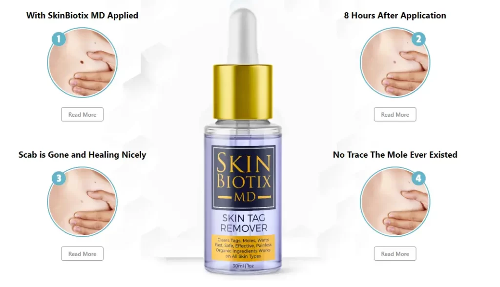 Eden Skin Tag Remover-how-it-works